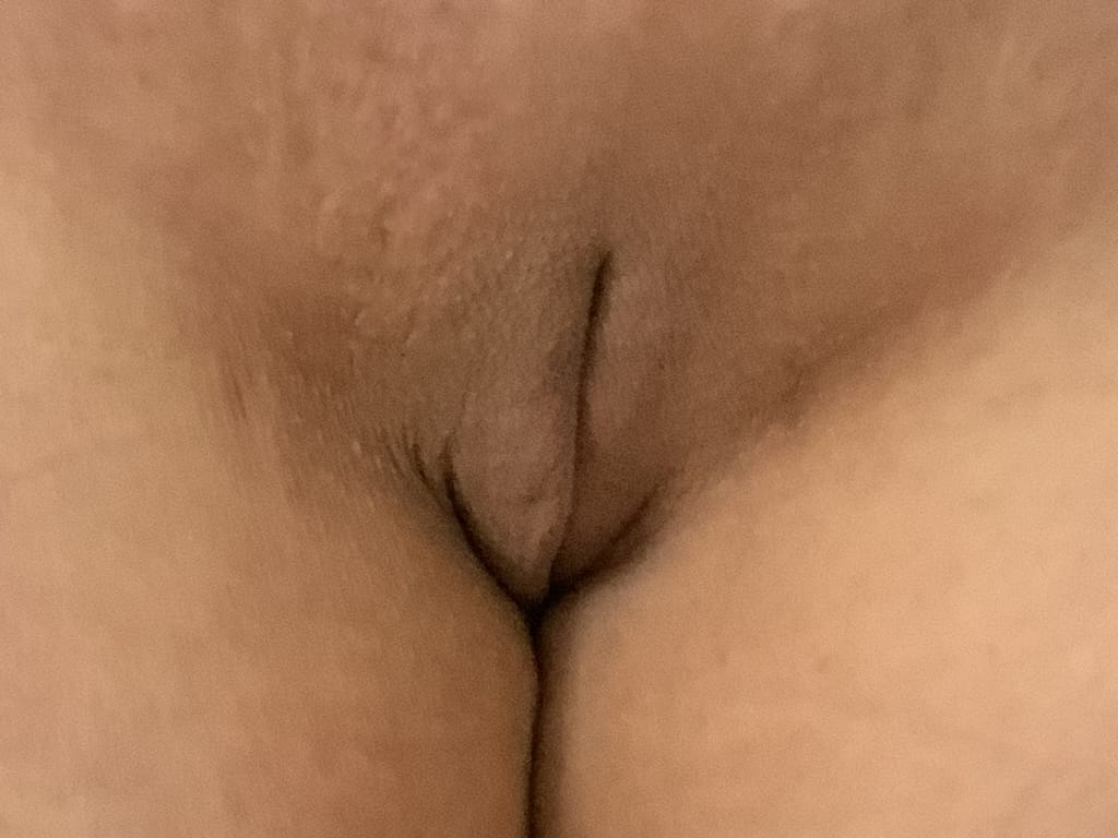 woman 6 months after Labia Minora surgery