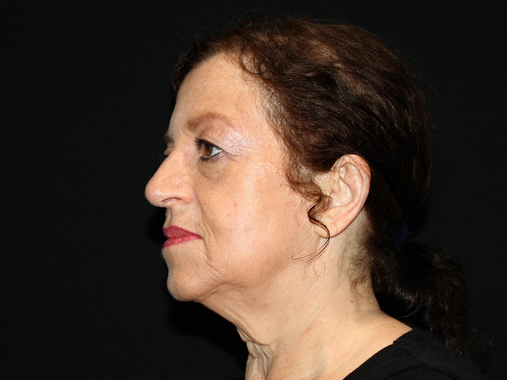 Angie before her Concept Facelift