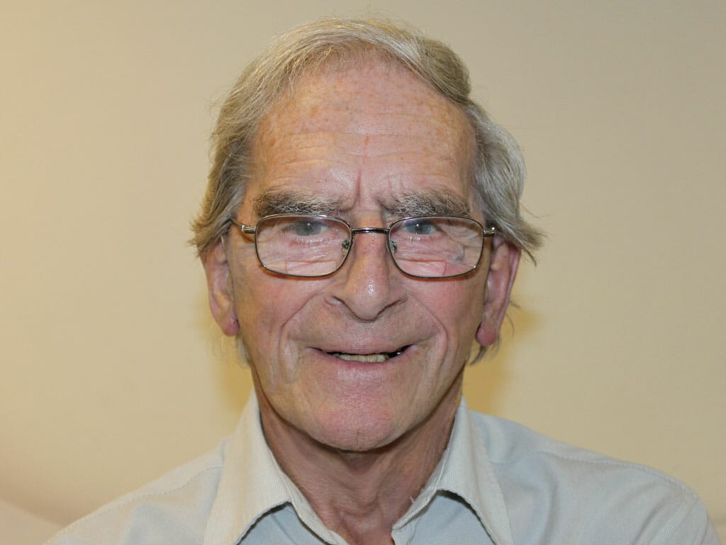 Reg-ConceptFacelift-After1week-84 Reg one week after his Concept Facelift