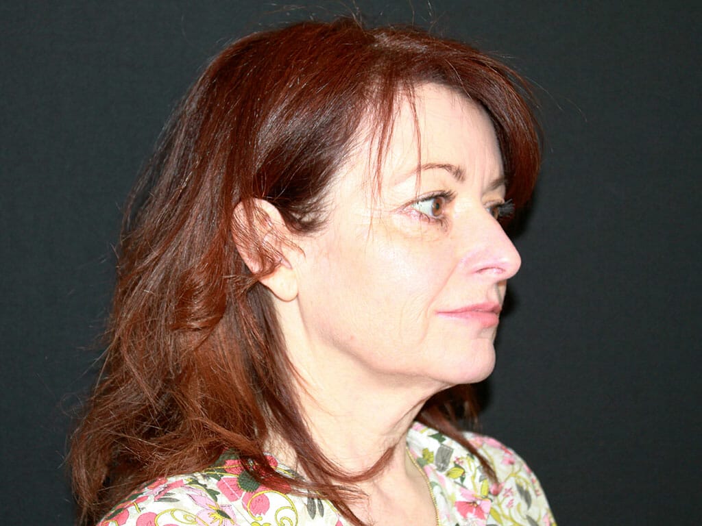 Wendy before her Concept Facelift