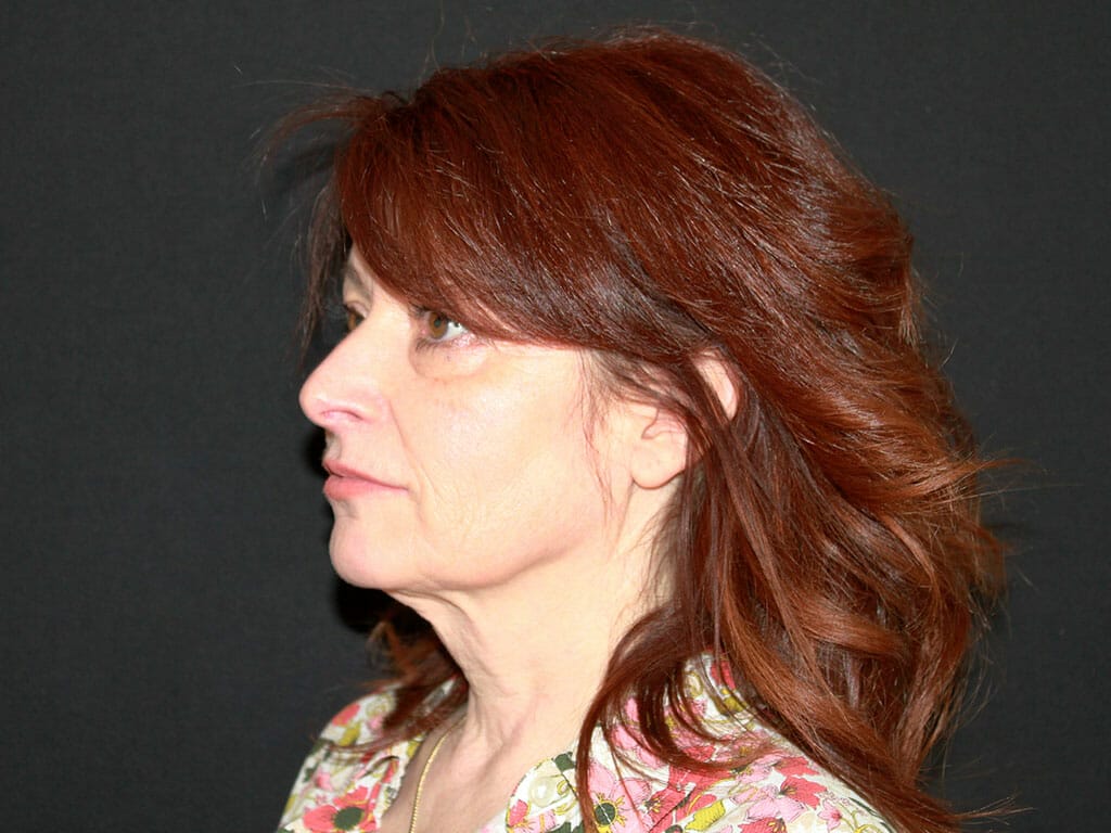 Wendy before her Concept Facelift