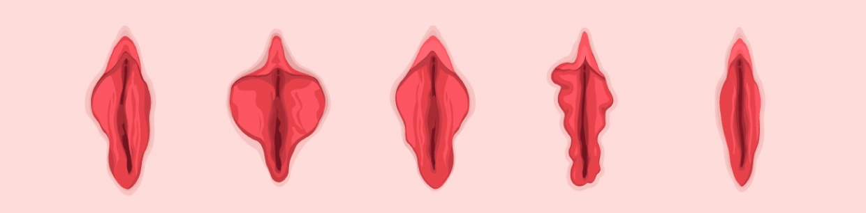 vulva Labia Minora - diagram showing differing shapes and sizes
