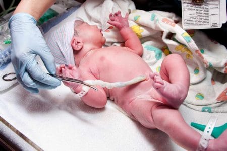 Newborn baby with umbilical cord about to be cut in hospital