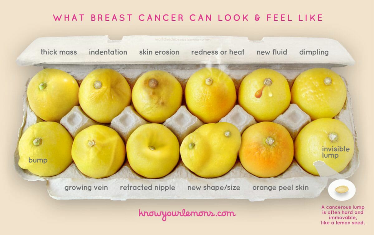 Signs of breast cancer #KnowYourLemons